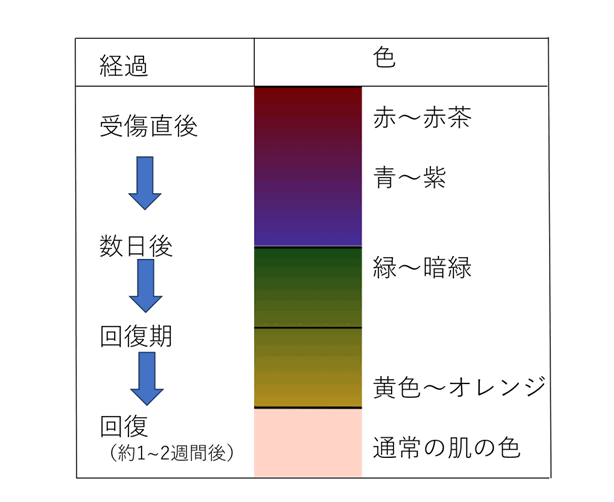 打撲痕の色の経時的変化