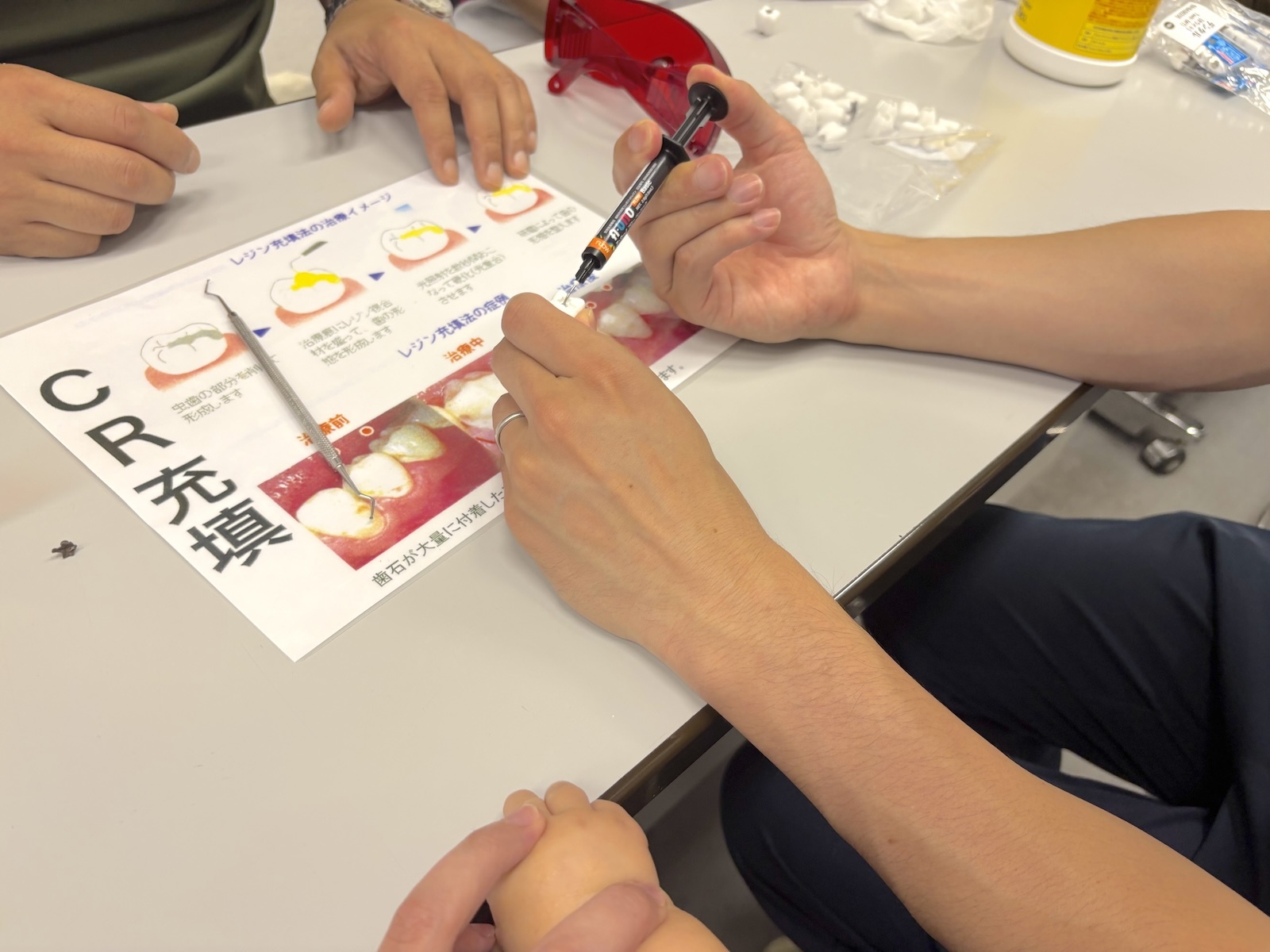 詰め物
